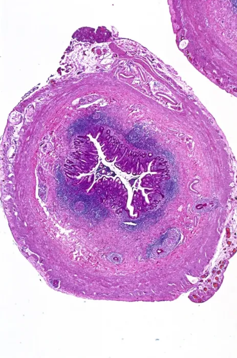 Framed Print : Appendix, light micrograph C016  /  0510
