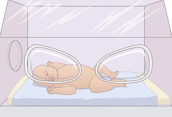 Baby in an incubator, artwork