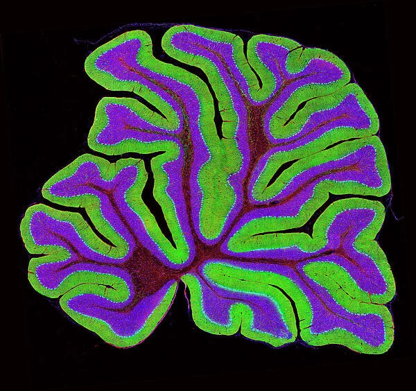 Cerebellum structure, light micrograph