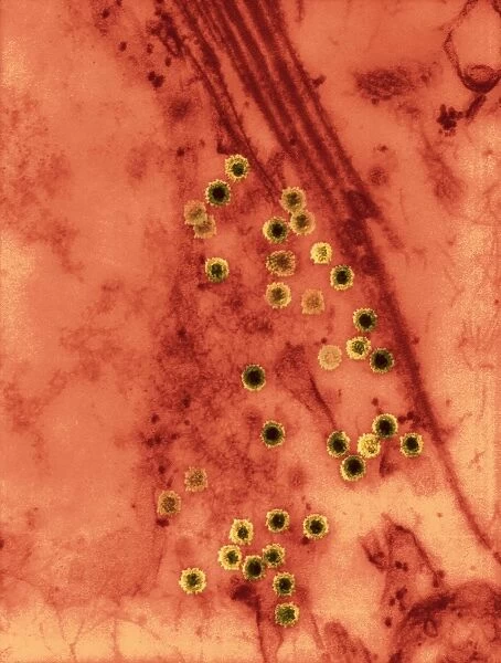 Colorado tick fever virus infection, TEM C016  /  9384