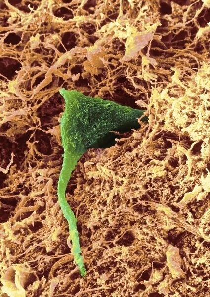 Coloured SEM of a nerve cell in brain tissue