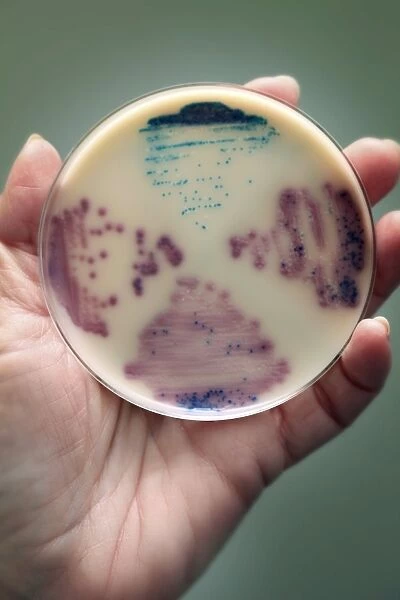 Cultured E. coli and Enterococcus bacteria