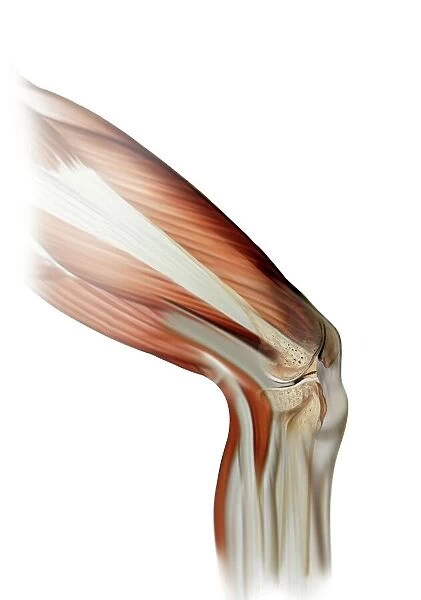 Damaged knee ligament, artwork