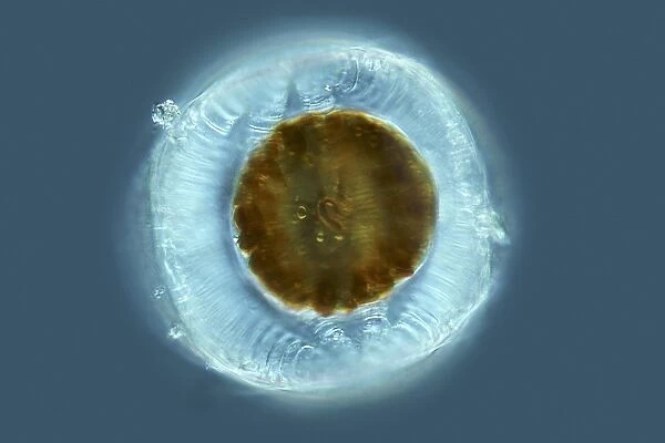 Diatom, light micrograph C014  /  4677