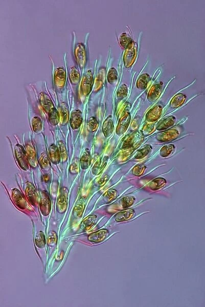 Golden algae, light micrograph