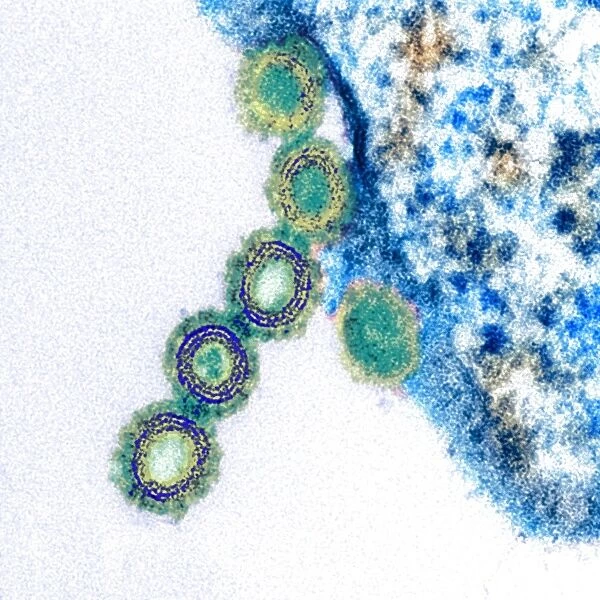 H1N1 swine flu virus, TEM