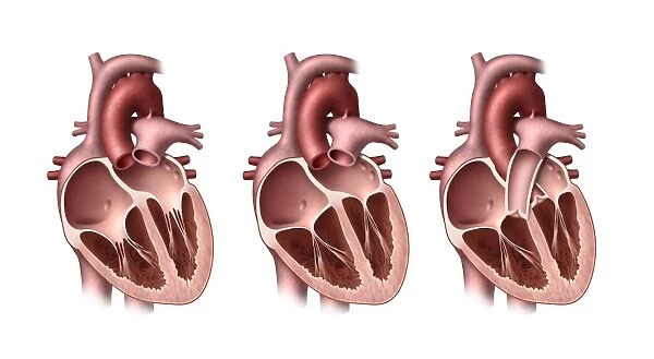 Heart valves, artwork