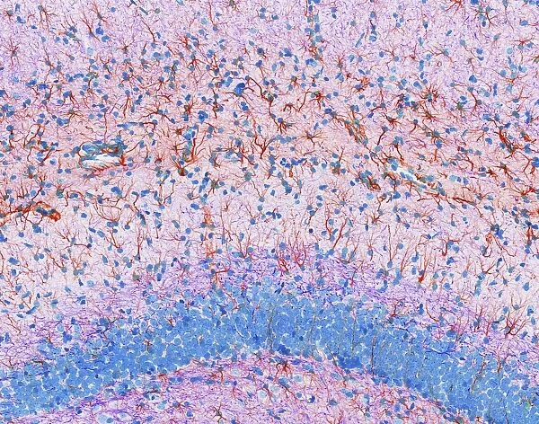 Hippocampus brain tissue