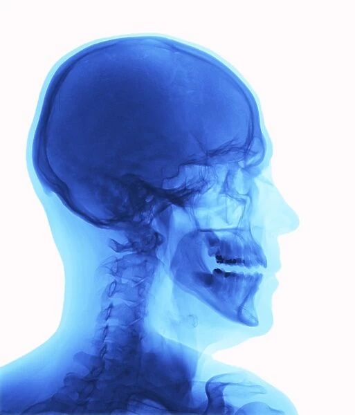 Human head, x-ray F007  /  1993