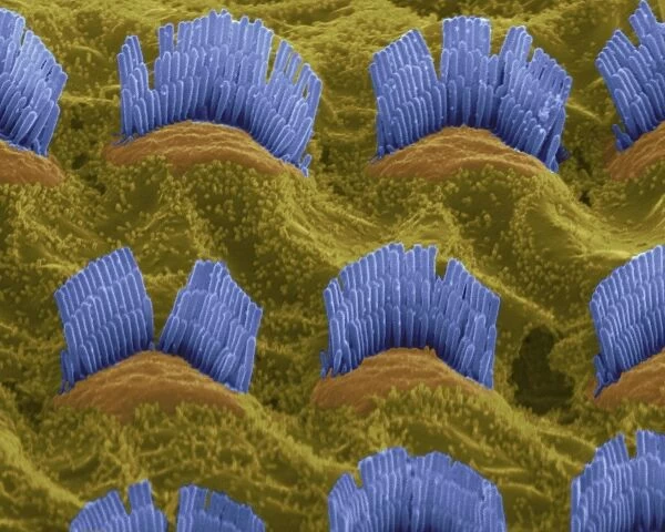 Inner ear hair cells, SEM C014  /  4844