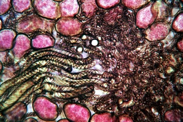 Liverwort spore elaters, light micrograph