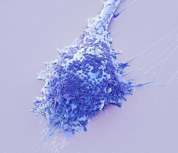 Microglial white blood cell, SEM C016  /  9115