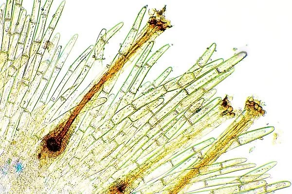 Moss reproductive parts, light micrograph