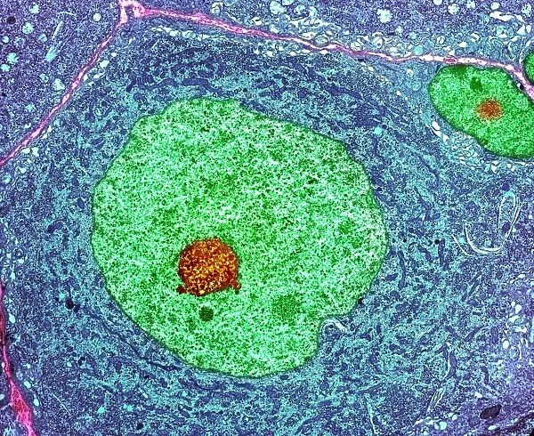 Nerve cell, TEM