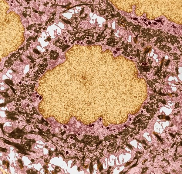 Skin cell, TEM