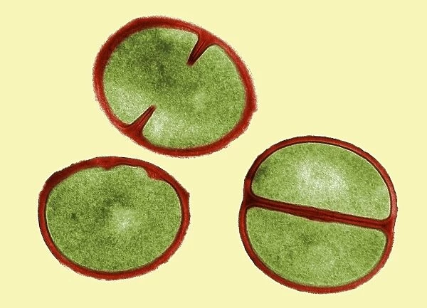 Staphylococcus aureus dividing, TEM