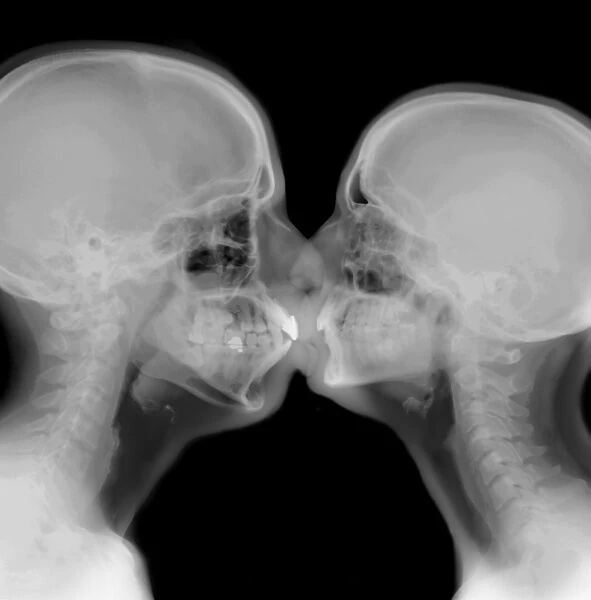 X-ray of a couple kissing