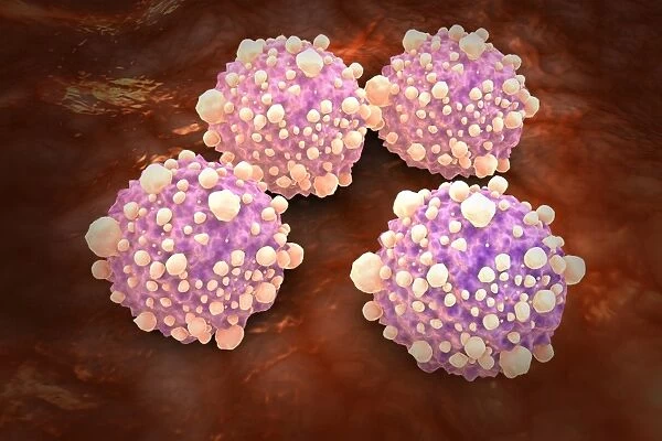 Microscipic view of pancreatic cancer cells