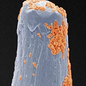 Bacteria on a pin, SEM