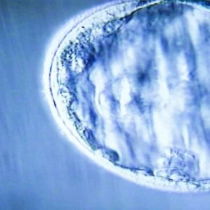Blastocyst embryo, light micrograph F008 / 3573
