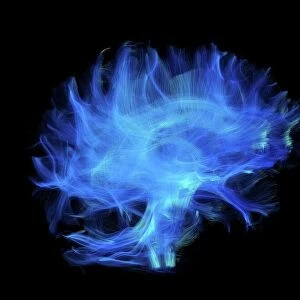 Brain fibres, DTI MRI scan C017 / 7035