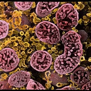 Coloured SEM of mitochondria in ovarian cells
