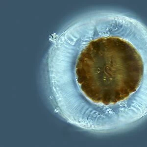 Diatom, light micrograph C014 / 4677