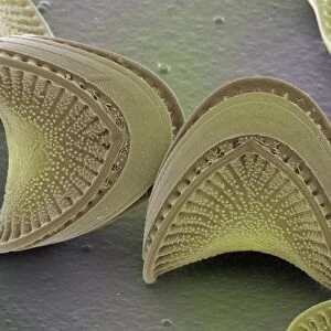 Diatoms, SEM