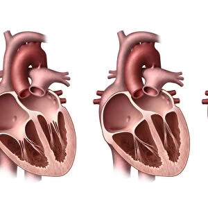 Heart valves, artwork