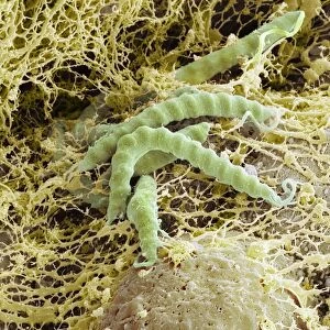 Helicobacter pylori bacteria, SEM C016 / 9136