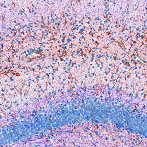 Hippocampus brain tissue