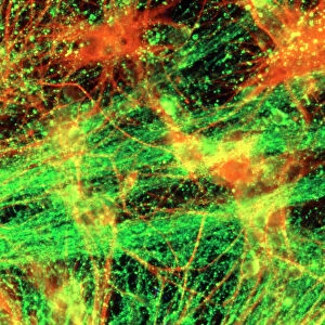 Immunofluorescent LM of neurons & astrocytes