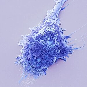Microglial white blood cell, SEM C016 / 9115