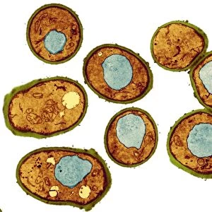 Yeast cells, TEM