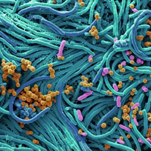 Bacteria found on mobile phone, SEM
