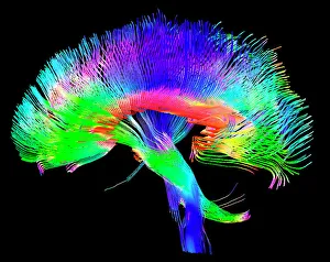 Trending: Brain pathways