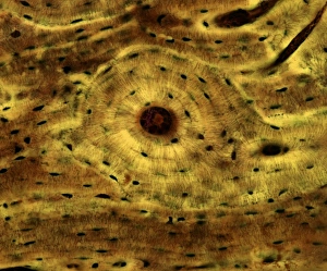 Compact bone, light micrograph