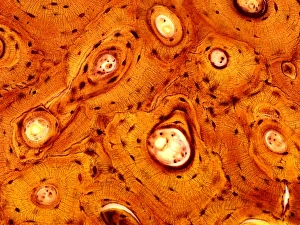 Compact bone, light micrograph
