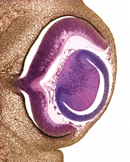 Embryonic Prints: Developing pig eye, light micrograph