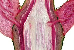 Leaf stem node, light micrograph
