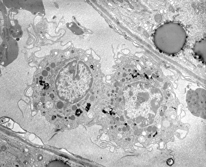 Lysosome Photos Science Photo Library Lysosome Photos Science Photo Library