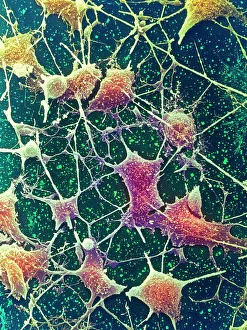 Nerve cells, SEM Nerve cells, SEM