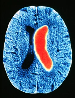 Stroke Prints: Stroke
