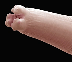 Threadworm, SEM