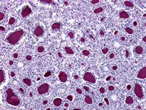 Thyroid, light micrograph
