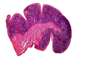 Tonsil tissue, light micrograph