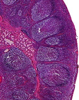Node Prints: Tonsil tissue, light micrograph