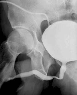 Middle Aged Prints: Voiding cystourethrogram, X-rays C018 / 0577