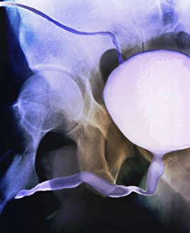 Middle Aged Prints: Voiding cystourethrogram, X-rays C018 / 0579